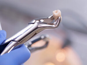 cirurgia oral