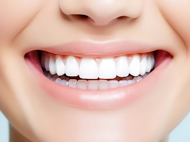 estética dental