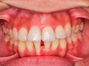 periodontia