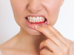periodontia